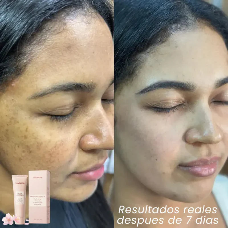 Quarxery Gel Exfoliante ACLARADOR - Últimas 7 Unidades 🔥