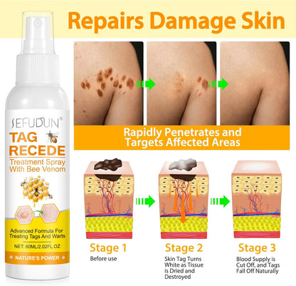 Tag Recede Eliminador de verrugas