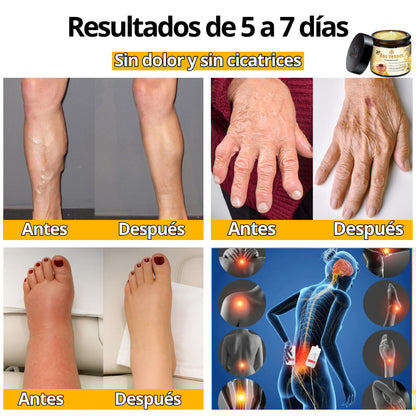 Bee Venom Bswell - Crema Para Dolores con Veneno de Abeja - Últimas 7 Unidades 🔥