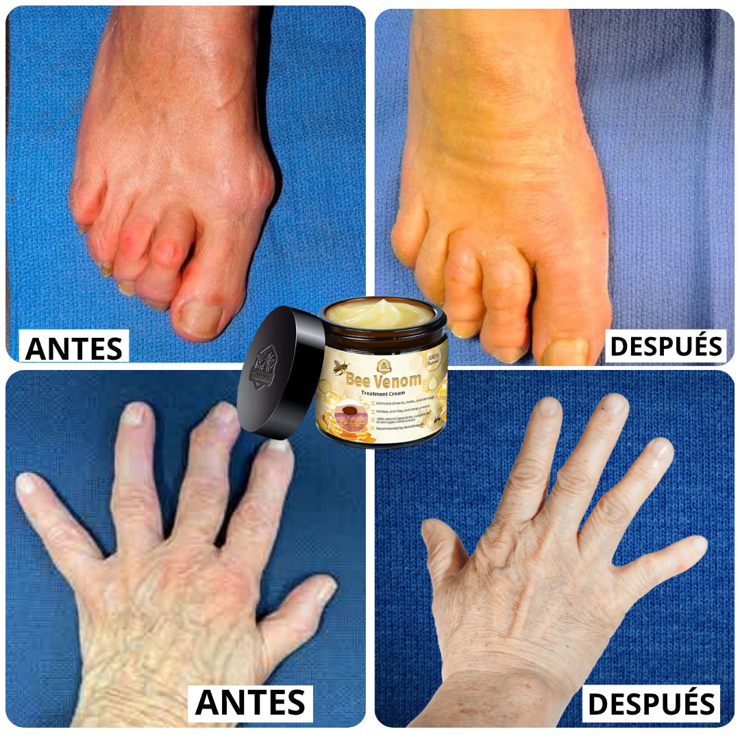 Bee Venom Bswell - Crema Para Dolores con Veneno de Abeja - Últimas 7 Unidades 🔥