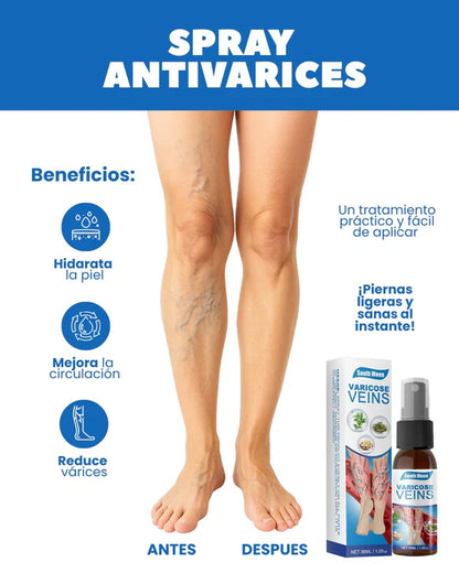 SPRAY ANTI VARICES - ADIOS VENAS  (30 ml) -Últimas 7 Unidades 🔥